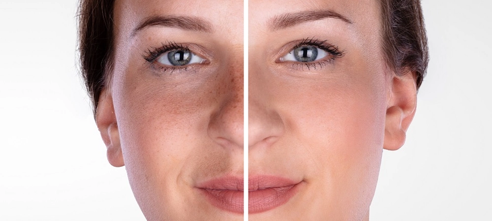 Resultados Bienestar y Belleza